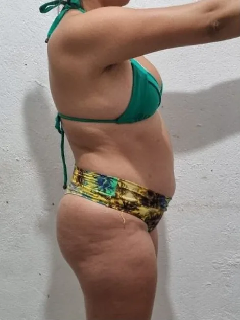 Aluna antes do Método ShapeFit